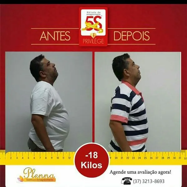 Foto 7 de Plenna Estética e Emagrecimento, Estética em Divinópolis - MG