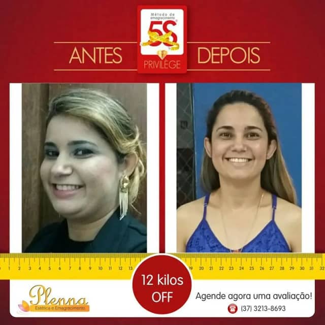 Foto 10 de Plenna Estética e Emagrecimento, Estética em Divinópolis - MG