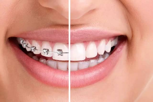 Foto 4 de Dr Luís Otávio Consultório, Dentistas em Divinópolis - MG