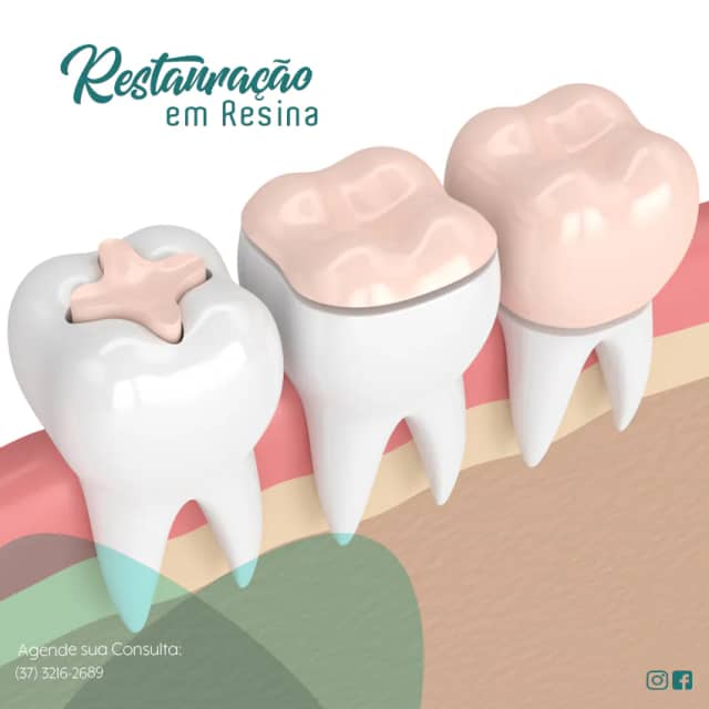 Foto 8 de Implantum Odontologia, Dentistas em Divinópolis - MG