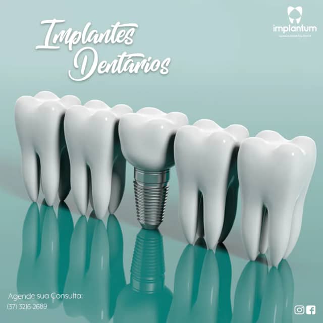 Foto 7 de Implantum Odontologia, Dentistas em Divinópolis - MG