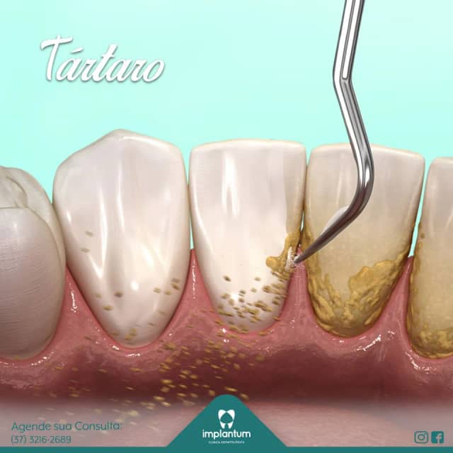 Foto 5 de Implantum Odontologia, Dentistas em Divinópolis - MG