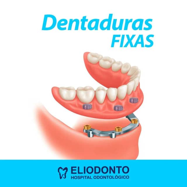 Foto 6 de Eliodonto, Dentistas em Divinópolis - MG