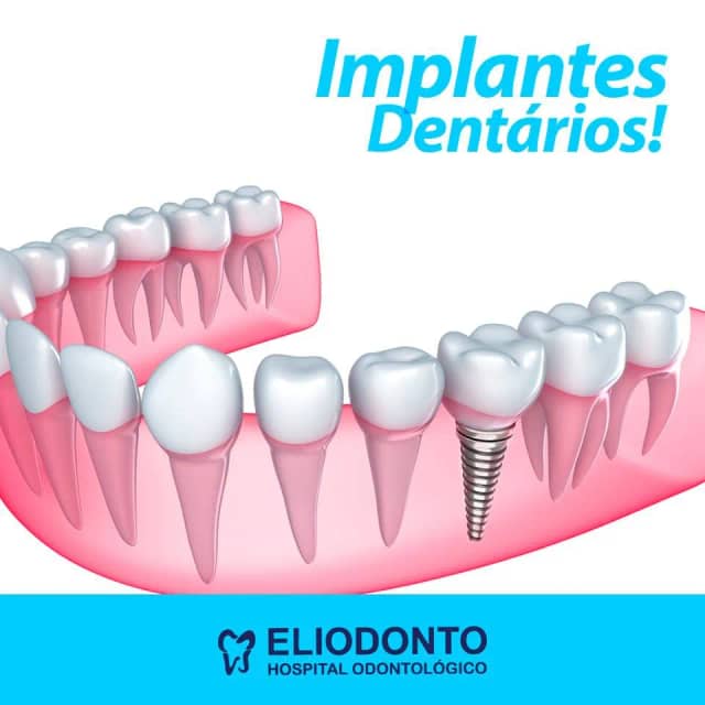 Foto 2 de Eliodonto, Dentistas em Divinópolis - MG